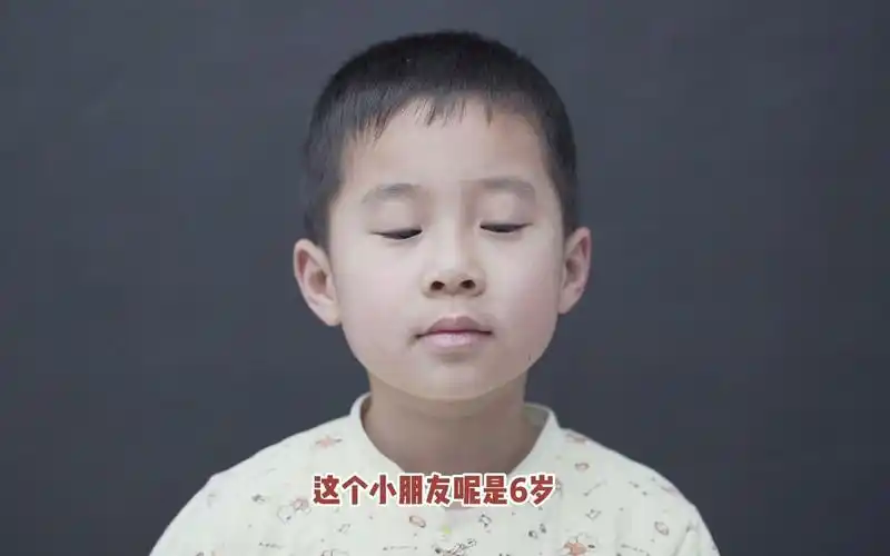 六岁男孩先天性上眼睑下垂