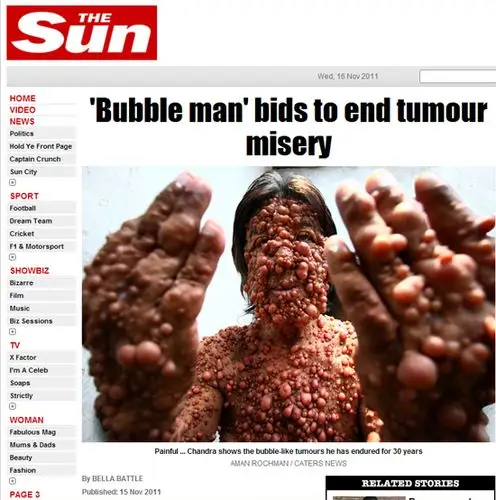 英国太阳报补缺