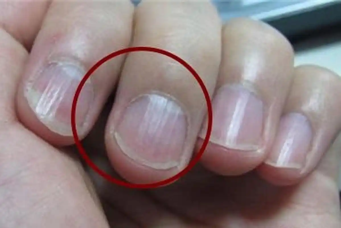 指甲上有竖纹是怎么回事啊-博云求真