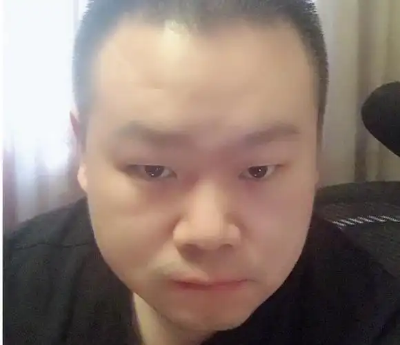 岳云鹏开始掉头发网友表示秃如其来