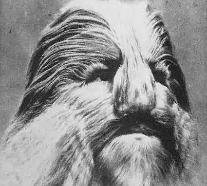 史上22大怪胎绝对会惊爆你眼球