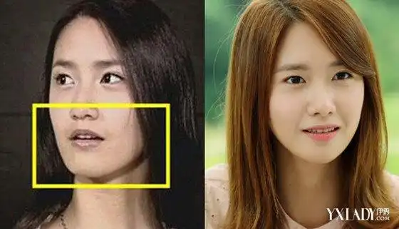 韩国整容成功的明星快看看你的女神有没有整