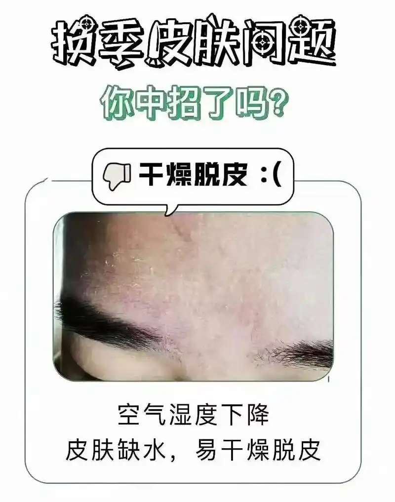 季节一变,对皮肤才是真正的考验干燥,敏感,脱皮 紧绷各种现 - 抖音