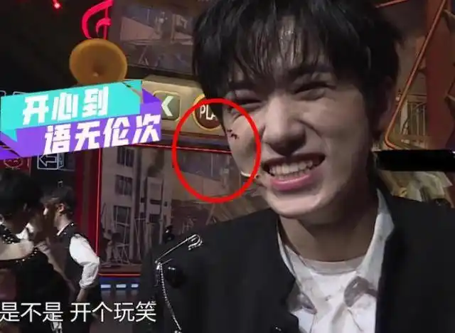 宋亚轩大笑时被怼脸拍,脸上两个坑格外清晰,是否整过一目了然?