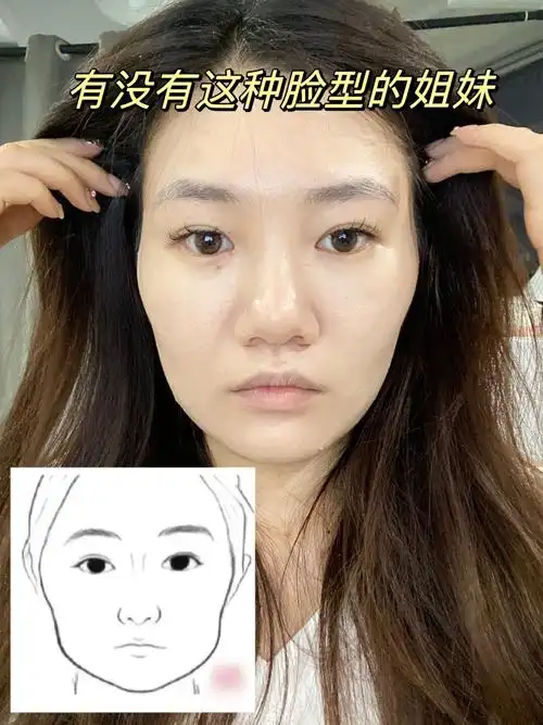 骨相修容真的很适合我们这种颧骨凸出,太阳穴凹陷,脸颊凹陷的脸型.