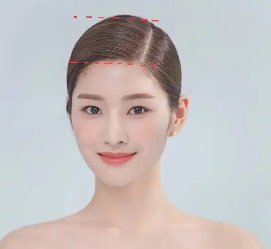 张立彬医生讲解高颅顶的好处 - 知乎