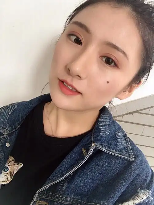 走心版小平行全切双眼皮手术 开内眼角 上眼睑提肌干货分享