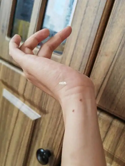 手上的两颗痣
