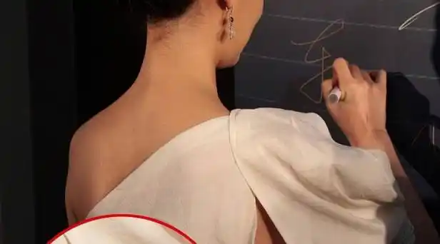 几种方法1挑选合适的内衣还有肩带:女性想要防止内衣带老是滑落的问题