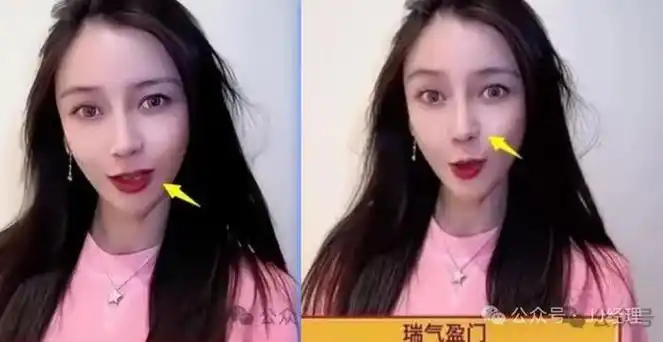 杨颖解封,卷土重来:面相怪异,鼻子歪了|baby|angelababy|卷土重来