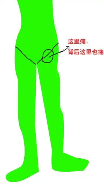 大腿根部痛,_百度知道