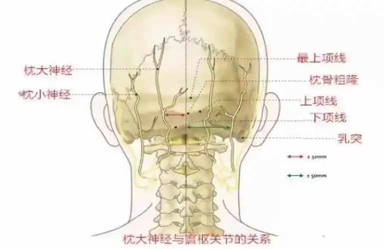 详解颈部肌筋膜性疼痛