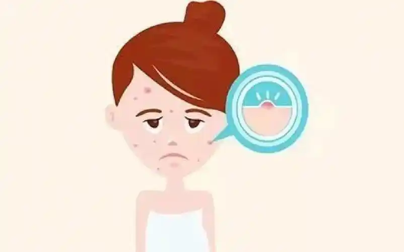 患有毛囊炎该怎么办?如何治疗?