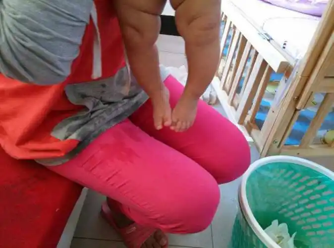 我孩子刚四个多月,腿比较弯,我怕是o型腿,需要去医院看看吗,懂的人