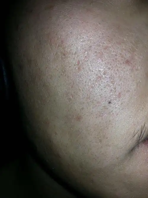 皮肤差到这种程度,该如何补救