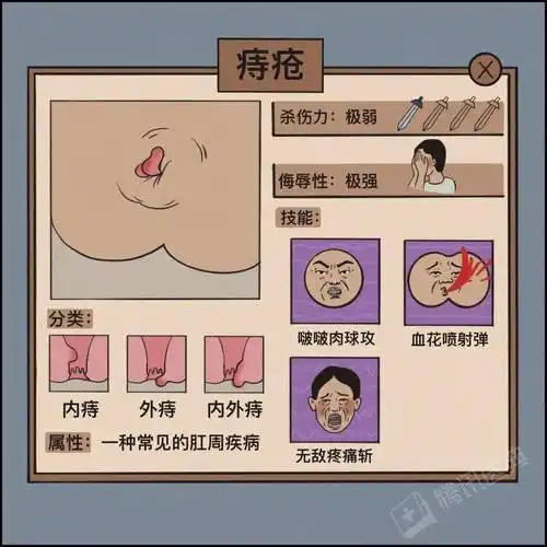 有痔疮的人将经历什么附上最全菊花呵护宝典