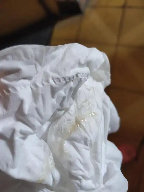 求助月经结束后白带带血四天