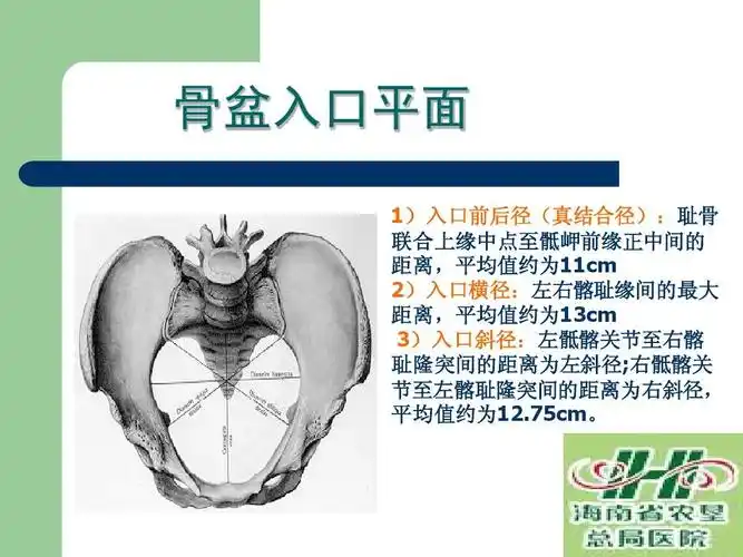 无忧文档 所有分类 医药卫生 正常分娩 妇产科教材ppt 骨盆入口平面 1