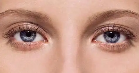 下眼睑为三阴三阳之处,另名为子女宫,卧蚕,主管子女有无,子女健康