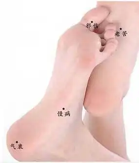 脚底有痣代表什么脚底有痣图解大全