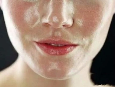 和油光暗沉脸说拜拜,用植物医生高山奇迹水就够了_凤凰网财经_凤凰网