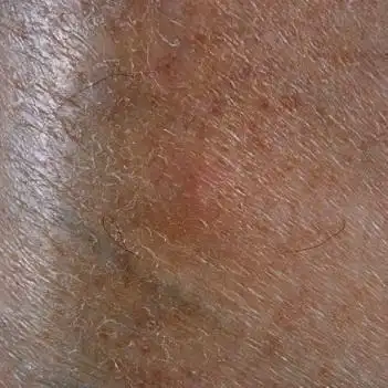 油性皮肤严重缺水怎么补水最有效(皮肤严重缺水怎么补水)(1)