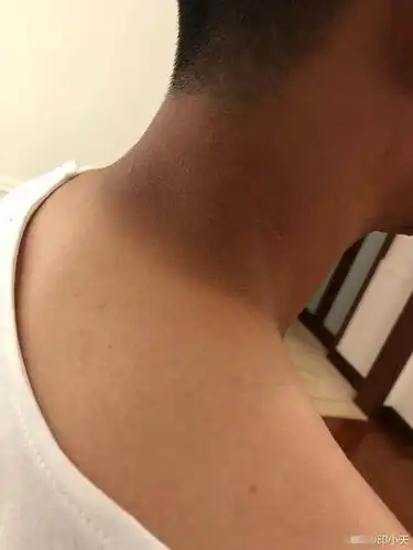 印小天晒热带雨林拍戏脖子脚晒黑照,网友纷纷赞其敬业注意防晒!