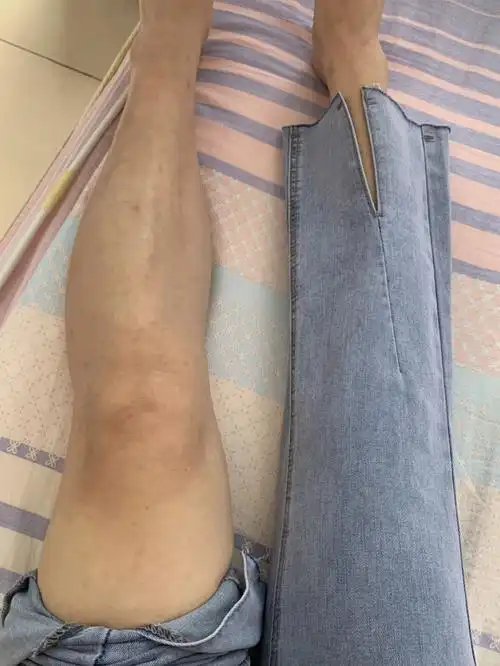 大腿53小腿347575小腿粗的姐妹都去冲吖