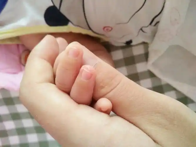 满月宝宝指甲边爆皮,怎么回事?怎么办?