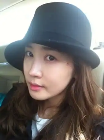 李多海拍戏脸部受伤 担心留伤疤晒自拍照(图)