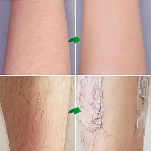 正品天然植物脱毛膏霜去除腿毛腋下腋毛男女脱毛膏