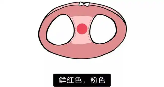 鲜红色是新鲜血粉色是新鲜的血混合白带这两种情况吧如果不是你大姨妈