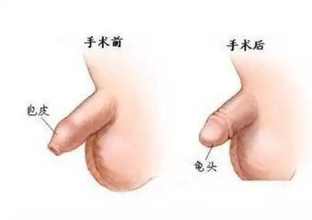 割包好处和坏处相关文章