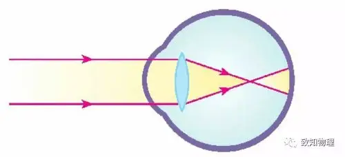 近视眼只能看清近处的物体,看不清远处的物体.