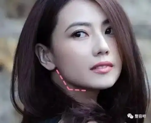 拿什么拯救你,我无处安放的双下巴?