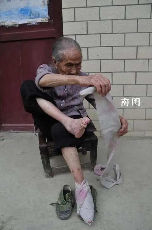 中国最后的三寸金莲 双脚用布紧紧裹住 看着都揪心