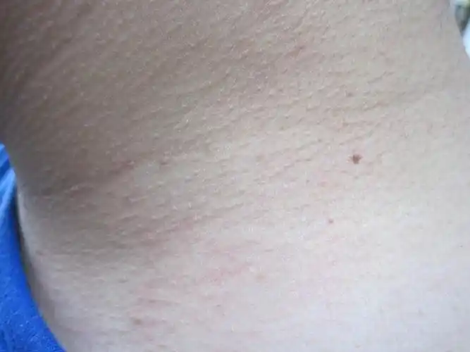 各位老师这都是什么啊特别是脖子上的小肉粒