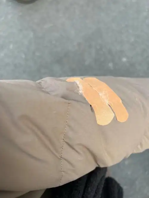 羽绒衣破了怎么补