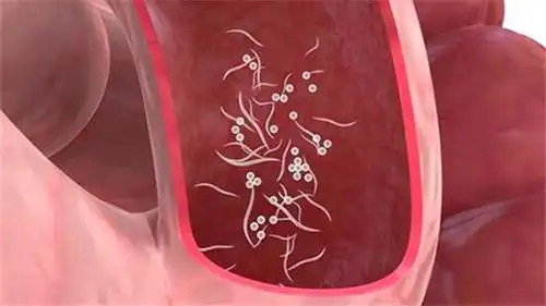 如果儿童患有"蛲虫病"病,主要表现为会y部,肛周瘙痒,出现睡眠不安