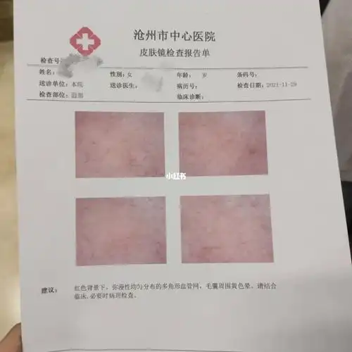 过敏换季考研被爱