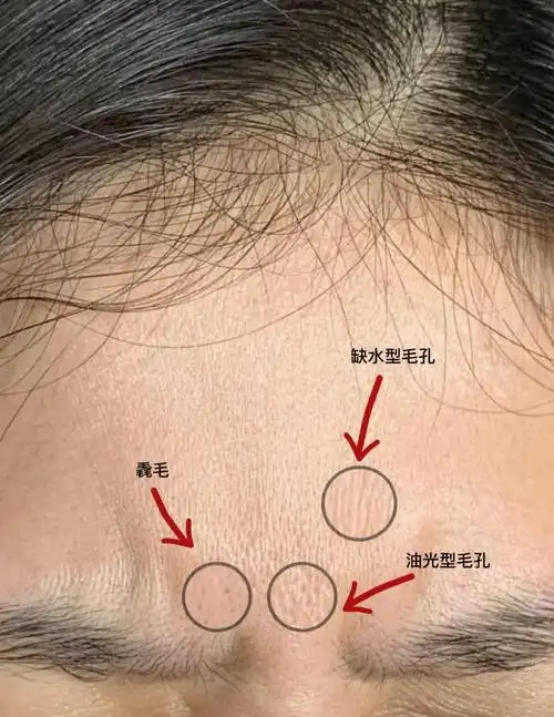 毛孔粗大?试试这些方法!