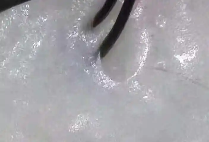 头皮健康的重要性