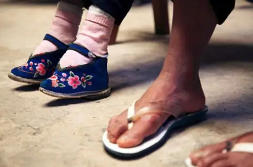 【转载】没见过吧:中国女人裹脚是这样的!