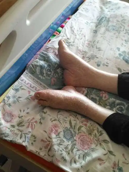 目前,在中国和武汉市,百岁老人还不少,但双百岁老神仙夫妻还真罕见.