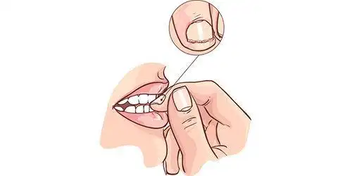 看电焊会眼瞎?真相是