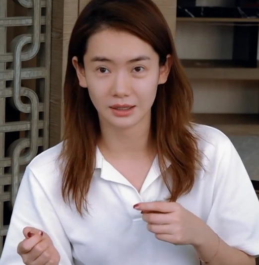 不愧是"戚哥"!戚薇素颜直接出镜,双眼皮上刀疤很真实,佩服!