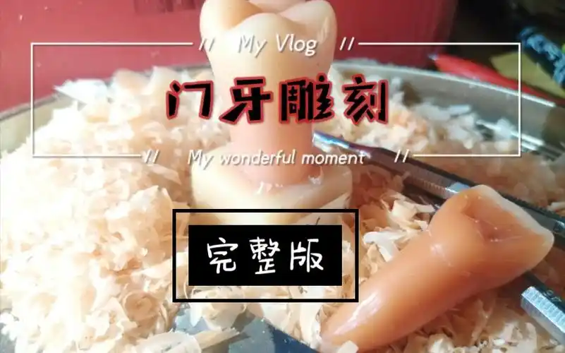 雕牙视频门牙雕刻全过程
