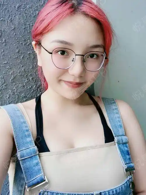 假体隆胸术后8天_隆胸术后8天_胸部整形术后8天_听海的声音分享图片3