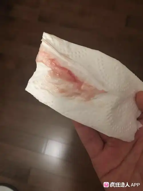 最近白带有一点点血丝,但不是一直有,每天偶尔有一点点