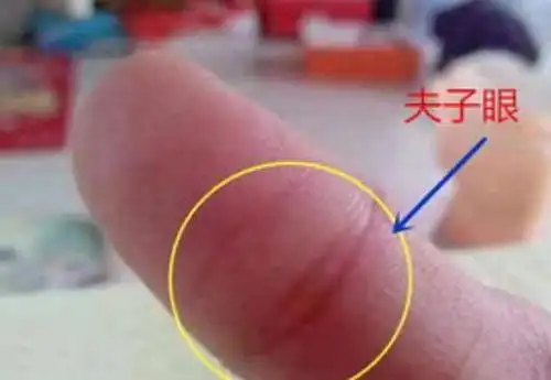 今天带大家认识一种较吉利,但并不是每个人都有的纹路——夫子眼